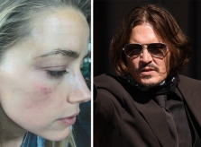 Amber Heard: 'Johnny Depp ném 30 chai lọ vào tôi như lựu đạn'