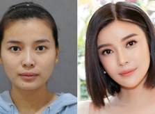 Biến đổi nhan sắc của diễn viên 'Hậu duệ mặt trời' Cao Thái Hà