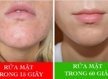 6 lỗi chăm sóc da nhiều người mắc