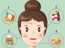 Chế độ dinh dưỡng phù hợp giúp da hết mụn