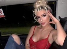 Hot girl tiêm filler để có gương mặt con nhà giàu như Kylie Jenner