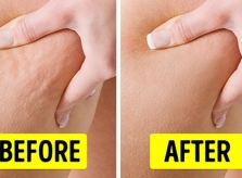 6 cách giảm sần vỏ cam vùng mông đùi
