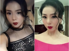 Hình ảnh mới nhất của Lệ Quyên sau khi tháo bỏ sụn mũi dao kéo