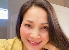 Mặt Hồng Ngọc hồi phục 95% sau tai nạn bỏng