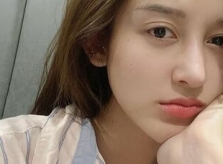 'Lú lẫn' khi dưỡng da, mặt Huyền My đau rát phát khóc