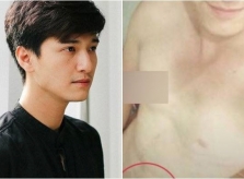 Huỳnh Anh nói gì trước nghi vấn lộ ảnh nóng