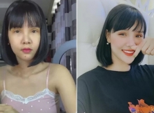 Fan chê hình ảnh mới của Kỳ Hân sau phẫu thuật cắt mí mắt