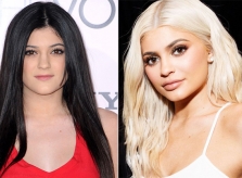 Kylie Jenner bơm môi vì lời chê của bạn trai đầu