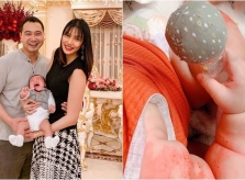 Lan Khuê xót xa khi con trai bị chàm