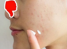 Chuyên gia da liễu chỉ điểm 7 mẹo làm đẹp tệ hại