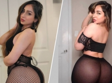 Một lần bơm mông, 6 tháng khỏi ngồi