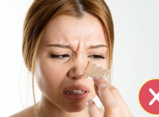 Cách chăm sóc da khi bị mụn đầu đen