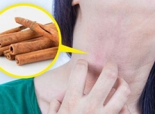 8 nguyên liệu làm đẹp tự nhiên dễ gây kích ứng da