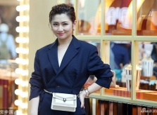 Selina chân vẫn đỏ bầm sau 9 năm bỏng nặng