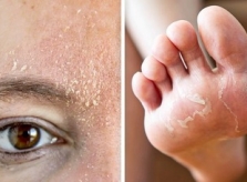6 tác hại với cơ thể khi uống cà phê ngay sau thức giấc