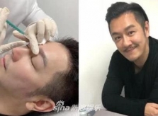 'Đoàn Dự' Trần Hạo Dân thẩm mỹ để trẻ trung ở tuổi 50