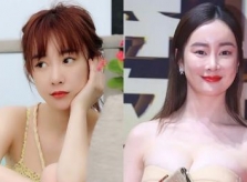 'Thảm họa thẩm mỹ' Trương Mông lấy lại nhan sắc